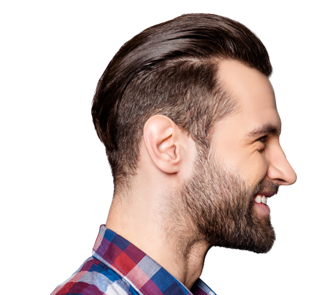 Hair transplant for men