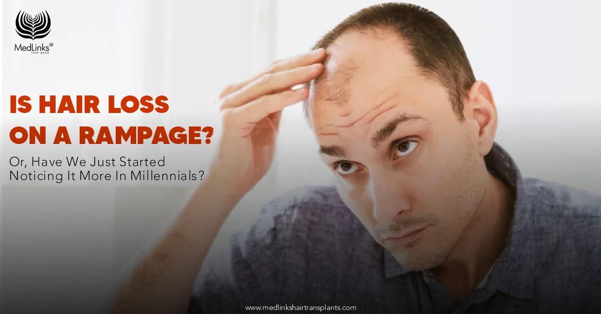 Is Hair Loss On A Rampage? Or, Have We Just Started Noticing It More In Millennials?