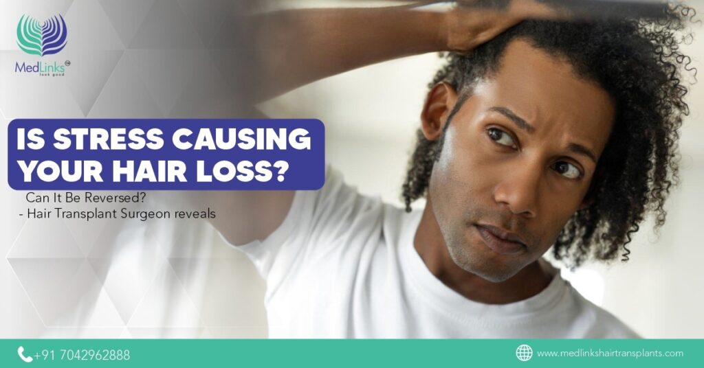 Stress Causing Your Hair Loss